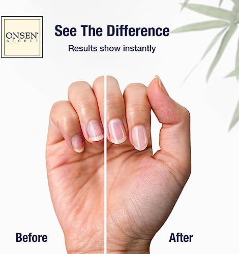 Onsen Secret Ultimate Nail Reboot Kit - Professional Nail File and Buffer, 3-Way Block w/Replacement Pads, Nail Strengthening Cuticle Cream, Reboot Oil & Anti Aging Hand Lotion
